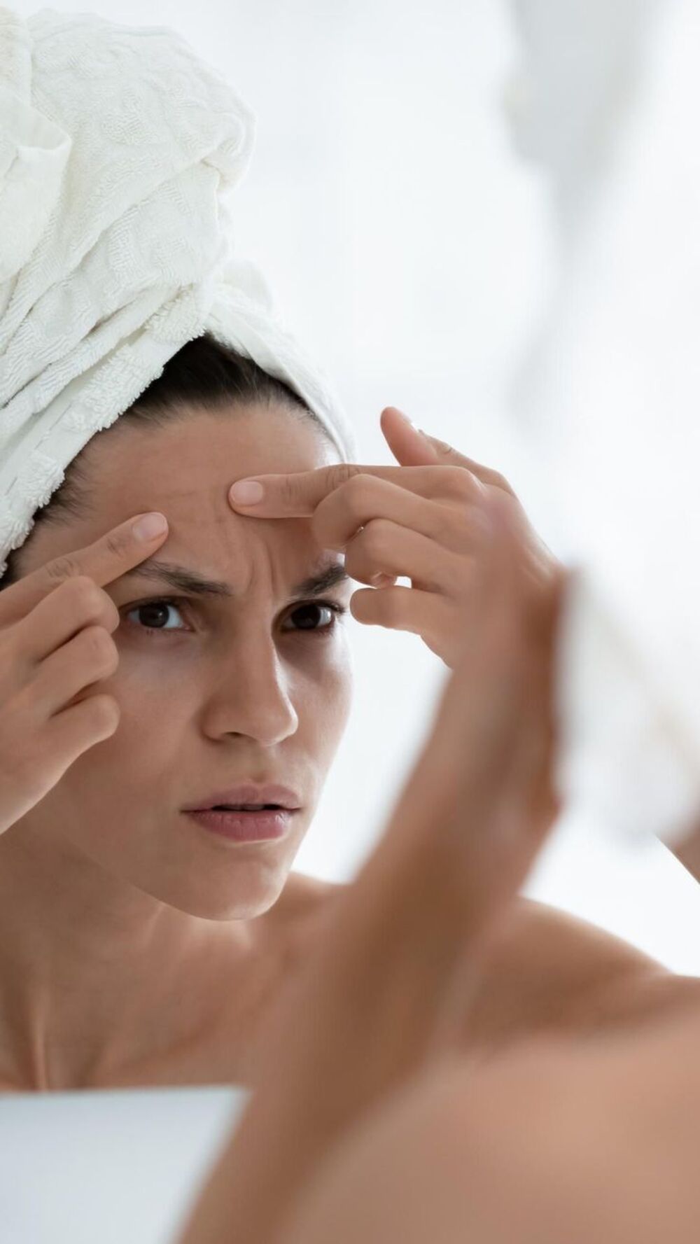 Can Coffee Cause Acne? The Truth Behind Your Brew and Your Skin